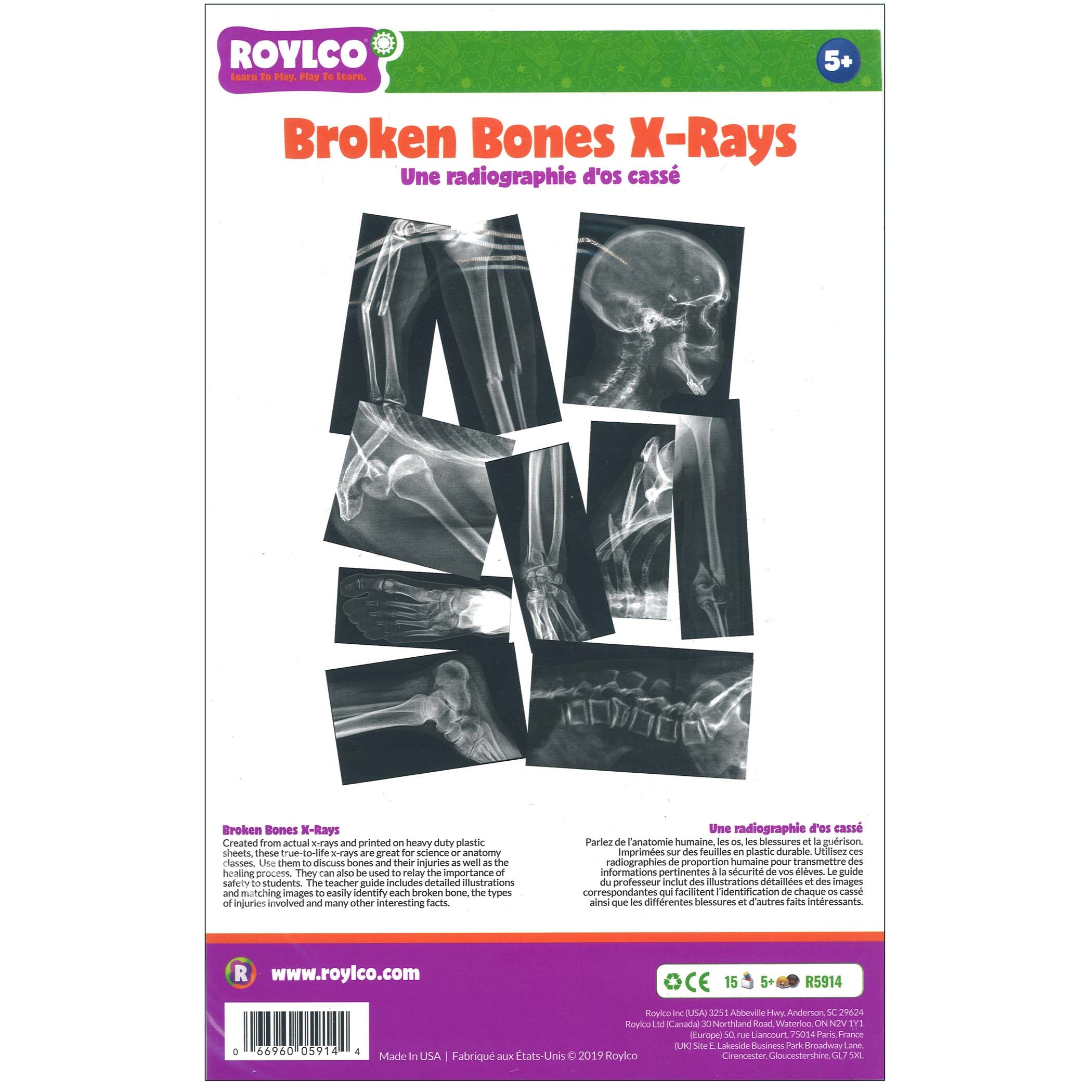 Broken Bones X-Ray Set, Pack of 15 - A1 School Supplies