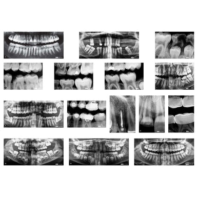 Dental X-Rays - A1 School Supplies